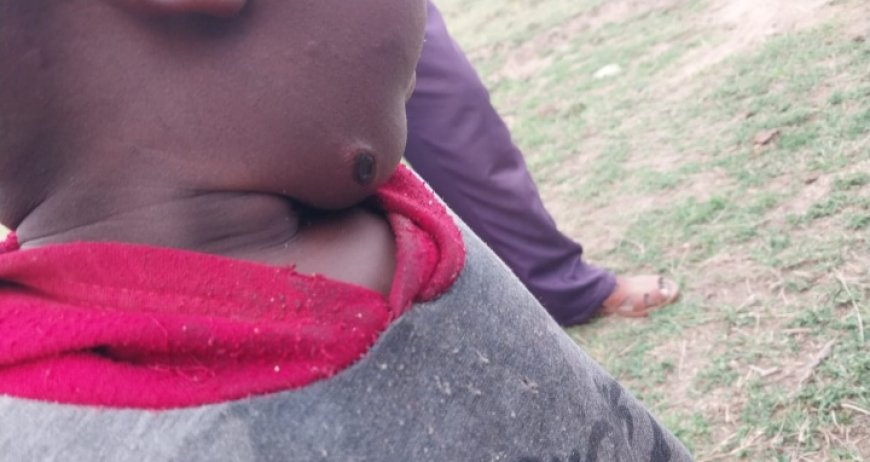 Two die from Anthrax infection in Narok