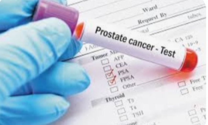 Men urged to take prostate cancer screening seriously